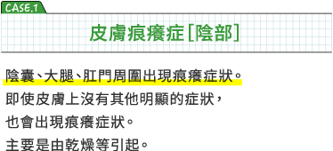 CASE1 皮膚痕癢症［陰部]　陰囊、大腿、肛門周圍出現痕癢症狀。即使皮膚上沒有其他明顯的症狀，也會出現痕癢症狀。主要是由乾燥等引起。